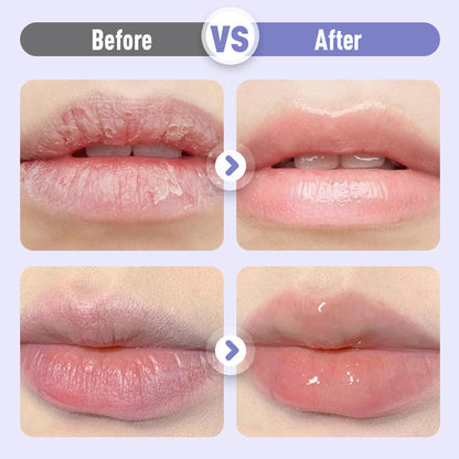 🔥BUY 1 GET 1 FREE🔥|Plumping & Anti-Wrinkle Hydrating Lip Serum💧💋