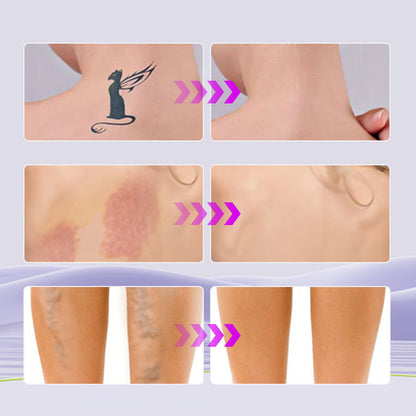 Waterproof Tattoo Cover Up Concealer