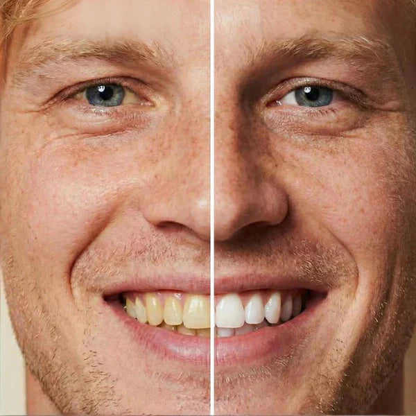 5ml Instant Whitening Tooth Paint