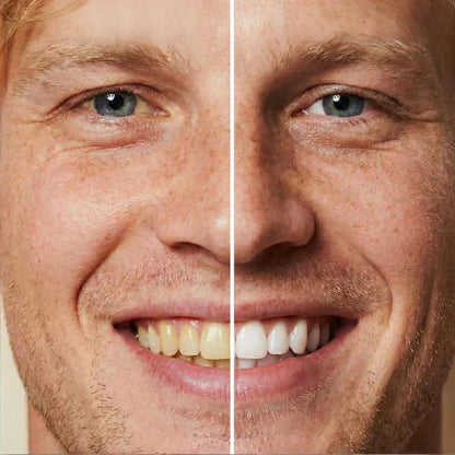 5ml Instant Whitening Tooth Paint