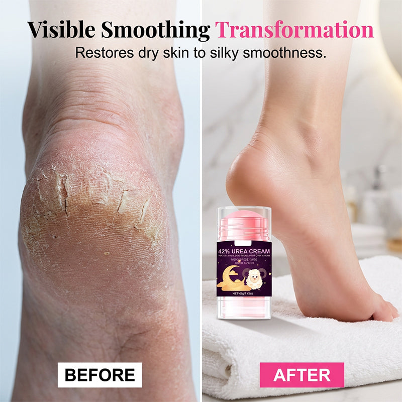 Heel Repair Salicylic Acid Cream🛡️Deeply Exfoliate, Moisturize And Repair Dry And Cracked Heels