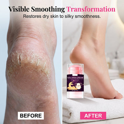 Heel Repair Salicylic Acid Cream🛡️Deeply Exfoliate, Moisturize And Repair Dry And Cracked Heels